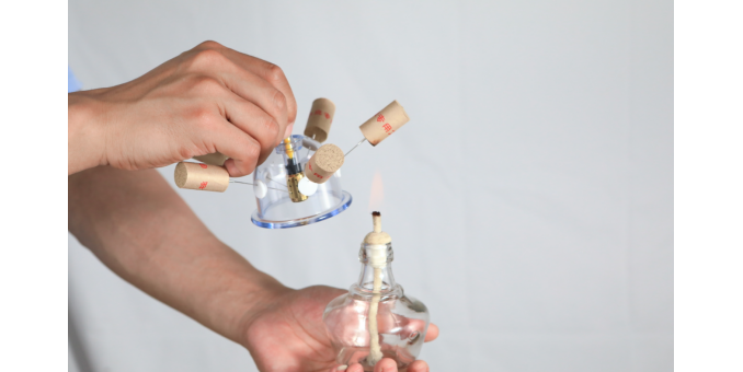 宇泉罐診罐療的發明與創新