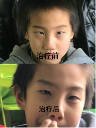 妙醫堂精手法傳承人&mdash;&mdash;王浩丞