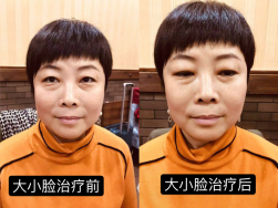 妙醫堂精手法傳承人&mdash;&mdash;王浩丞