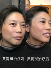 妙醫堂精手法傳承人&mdash;&mdash;王浩丞